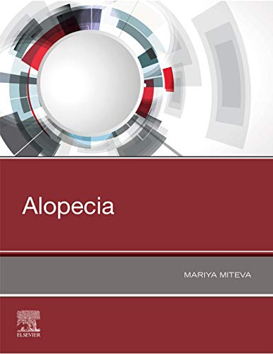 Ler Alopecia, do autor Mariya MITEVA