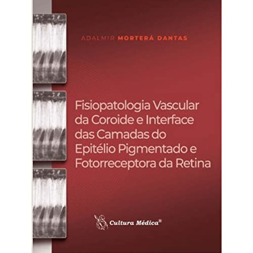 Ler Fisiopatologia Vascular da Coroide e Interface das Camadas do Epitélio Pigmentado e Fotorreceptora da Retina, do autor Adalmir Morterá Dantas e Outros