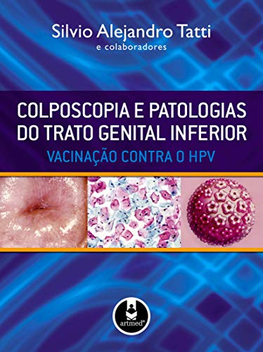 Ler Colposcopia e Patologias do Trato Genital Inferior: Vacinação Contra o HPV, do autor Silvio Alejandro Tatti