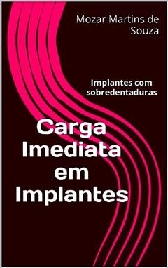 Carga Imediata em Implantes: Implantes com sobredentaduras, do autor Mozar de Souza