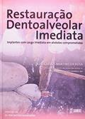 Ler Restauração Dentoalveolar Imediata - Implantes com Carga Imediata em Alvéolos Comprometidos, do autor José Carlos Martins da Rosa Ler Restauração Dentoalveolar Imediata - Implantes com Carga Imediata em Alvéolos Comprometidos, do autor José Carlos Martins da Rosa
