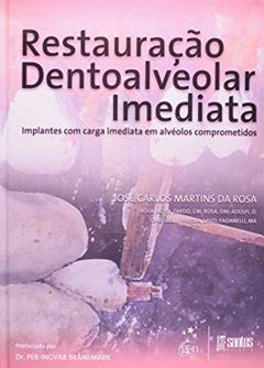 Restauração Dentoalveolar Imediata - Implantes com Carga Imediata em Alvéolos Comprometidos, do autor José Carlos Martins da Rosa