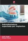 Ler Sobredentadura suportada por implantes, do autor Kapil Singla; Deepak Goyal Ler Sobredentadura suportada por implantes, do autor Kapil Singla; Deepak Goyal