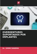 Ler OVERDENTURES SUPORTADOS POR IMPLANTES, do autor Simmi Sharma Ler OVERDENTURES SUPORTADOS POR IMPLANTES, do autor Simmi Sharma