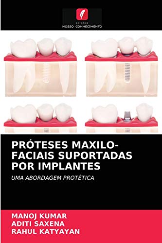 Ler PRÓTESES MAXILO-FACIAIS SUPORTADAS POR IMPLANTES: UMA ABORDAGEM PROTÉTICA, do autor Manoj Kumar; Aditi Saxena; Rahul Katyayan