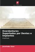 Ler Overdentures Suportadas por Dentes e Implantes: Simplificado, do autor Jaswinder Kaur