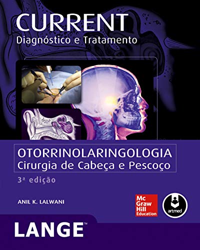 Ler Otorrinolaringologia: Cirurgia de Cabeça e Pescoço, do autor Anil K. Lalwani
