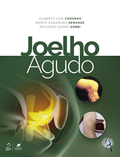 Ler Joelho Agudo, do autor Gilberto Luis CAMANHO; Marco Kawamura DEMANGE; Riccardo Gomes GOBBI