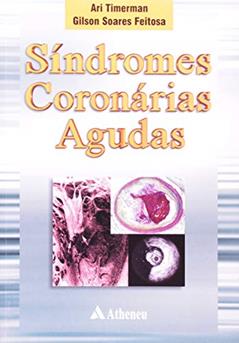 Síndrome Coronárias Agudas, do autor Ari Timerman; Gilson Soares Feitosa