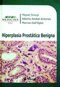 Ler Hiperplasia Prostática Benigna, do autor Miguel Srougi; Alberto Azobel Antunes; Marcos Dall'Oglio