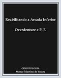 Ler Reabilitando a Arcada Inferior Overdenture e Prótese Fixa: Prótese Odontológica, do autor Mozar Martins