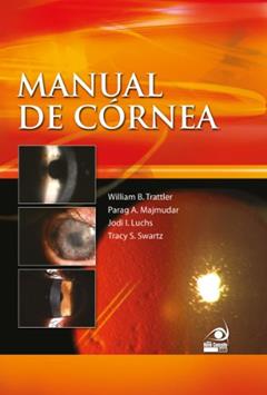 Manual de Córnea, do autor Willian Tratller