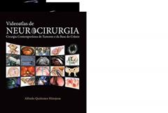 VIDEOATLAS DE NEUROCIRURGIA, do autor ALFREDO QUINONES HINOJOSA