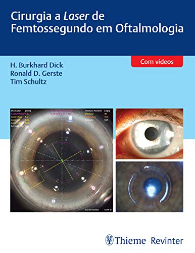 Ler Cirurgia a Laser de Femtossegundo em Oftalmologia, do autor H. Burkhard Dick; Ronald D. Gerste; Tim Schultz