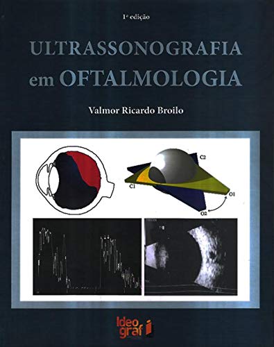 Ler Ultrassonografia em Oftalmologia, do autor Valmor Ricardo Broilo