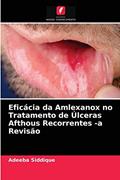 Ler Eficácia da Amlexanox no Tratamento de Úlceras Afthous Recorrentes -a Revisão, do autor Adeeba Siddique Ler Eficácia da Amlexanox no Tratamento de Úlceras Afthous Recorrentes -a Revisão, do autor Adeeba Siddique