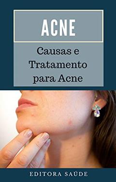 Acne: Causas e Tratamento para Acne, do autor Editora Saúde