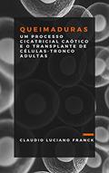 Ler Queimaduras: Um processo cicatricial caótico e o transplante de células-tronco adultas, do autor Claudio Luciano Franck Ler Queimaduras: Um processo cicatricial caótico e o transplante de células-tronco adultas, do autor Claudio Luciano Franck