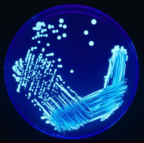 Ler Introdução à microbiologia clínica e ao tratamento das doenças infecciosas, do autor Eurico de Aguiar Ler Introdução à microbiologia clínica e ao tratamento das doenças infecciosas, do autor Eurico de Aguiar