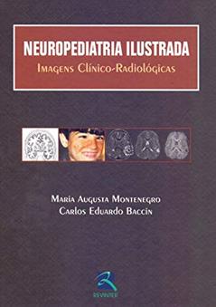 Neuropediatria Ilustrada: Imagens Clínico-Radiológicas, do autor Maria Augusta Montenegro; Carlos Eduardo Baccin