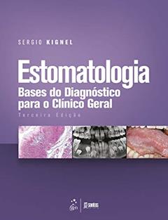 Estomatologia - Bases do Diagnóstico para o Clínico Geral, do autor Sergio KIGNEL