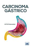 Ler Carcinoma Gástrico, do autor António Bernardes