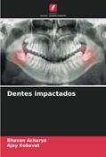 Ler Dentes impactados, do autor Bhavan Acharya; Ajay Kubavat