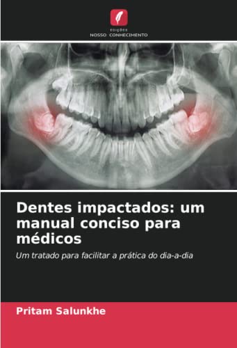 Ler Dentes impactados: um manual conciso para médicos: Um tratado para facilitar a prática do dia-a-dia, do autor Pritam Salunkhe