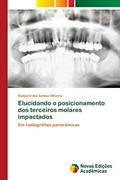 Ler Elucidando o posicionamento dos terceiros molares impactados: Em radiografias panorâmicas, do autor Rudyard dos Santos Oliveira Ler Elucidando o posicionamento dos terceiros molares impactados: Em radiografias panorâmicas, do autor Rudyard dos Santos Oliveira