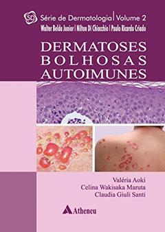 Dermatoses Bolhosas Autoimunes (Volume 2), do autor Valéria Aoki; Celina Wakisaka Maruta; Claudia Giulia Santi