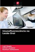 Ler Imunofluorescência na Lesão Oral, do autor Lajri Bagde; Ashish Lanjekar; Ramhari Sathawane