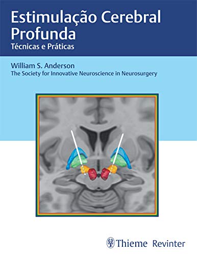Ler Estimulação Cerebral Profunda: Técnicas e Práticas, do autor Anderson William S.
