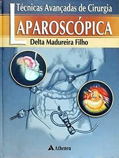 Técnicas Avançadas de Cirurgia Laparoscópica (eBook), do autor Delta Madureira Filho