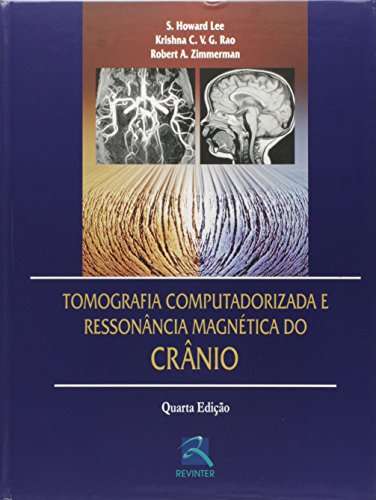 Ler Tomografia Computadorizada e Ressonância Magnética do Crânio, do autor S. Howard Lee; Krishna C. V. G. Rao; Robert A. Zimmerman