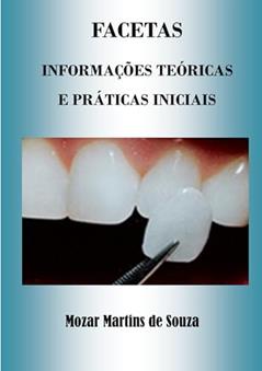 Facetas: Prótese Odontológica, do autor Mozar M de Souza