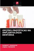 Ler OPÇÕES PROTÉTICAS NA IMPLANTOLOGIA DENTÁRIA, do autor RANJEET GHADAGE; Anjali MENDHE