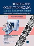 Ler Tomografia Computadorizada: Manual Prático de Ensino - Uma Abordagem Sistemática à Interpretação de TC, do autor Mathias Hofer Ler Tomografia Computadorizada: Manual Prático de Ensino - Uma Abordagem Sistemática à Interpretação de TC, do autor Mathias Hofer