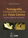 Ler Tomografia Computadorizada por Feixe Cônico - Interpretação e Diagnóstico para o Cirurgião-Dentista, do autor Marcelo Cavalcanti Ler Tomografia Computadorizada por Feixe Cônico - Interpretação e Diagnóstico para o Cirurgião-Dentista, do autor Marcelo Cavalcanti
