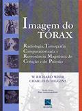 Ler Imagem do Tórax: Radiologia, Tomografia Computadorizada, e Ressonância Magnética do Coração e do Pulmão, do autor W. Richard Webb; Charles B. Higgins Ler Imagem do Tórax: Radiologia, Tomografia Computadorizada, e Ressonância Magnética do Coração e do Pulmão, do autor W. Richard Webb; Charles B. Higgins