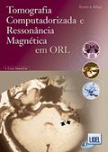 Ler Tomografia Computadorizada e Ressonância Magnética em ORL, do autor J. Cruz Maurício Ler Tomografia Computadorizada e Ressonância Magnética em ORL, do autor J. Cruz Maurício