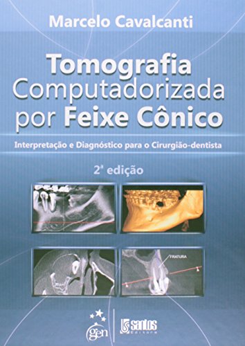 Ler Tomografia Computadorizada por Feixe Cônico - Interpretação e Diagnóstico para o Cirurgião-Dentista, do autor Cavalcanti