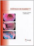 Ler Esôfago de Barrett, do autor Artur Parada
