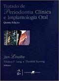 Ler Tratado de Periodontia Clínica e Implantologia Oral, do autor Lindhe