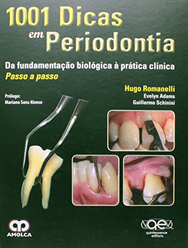 1001 Dicas em Periodontia. Da Fundamentação Biológica à Pratica Clínica Passo a Passo, do autor Hugo Romanelli