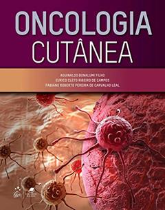 Oncologia Cutânea, do autor Aguinaldo Bonalumi