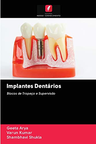 Ler Implantes Dentários: Blocos de Tropeço e Supervisão, do autor Geeta Arya; Varun Kumar; Shambhavi Shukla