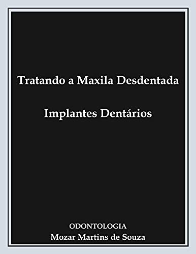Ler Tratando a Maxila Desdentada - Implantes Dentários: Prótese Odontológica, do autor Mozar Martins Ler Tratando a Maxila Desdentada - Implantes Dentários: Prótese Odontológica, do autor Mozar Martins