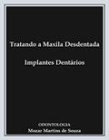 Ler Tratando a Maxila Desdentada - Implantes Dentários: Prótese Odontológica, do autor Mozar Martins