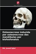 Ler Osteonecrose induzida por osteonecrose das mandíbulas por bisfosfonatos, do autor Md. Jawed Iqbal