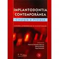 Ler Implantologia Contemporanea, do autor Francisco F. Todescan Ler Implantologia Contemporanea, do autor Francisco F. Todescan